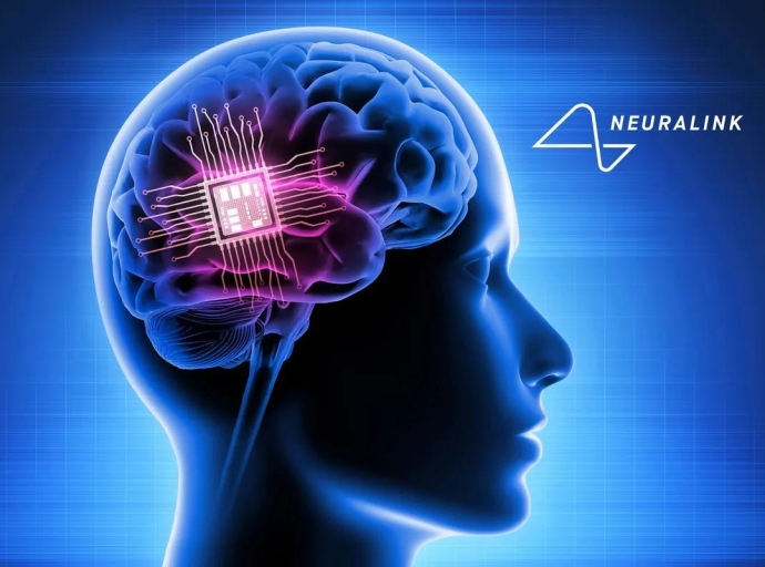 There’s Neuralink—and There’s the Mind-Reading Company That Might Surpass It
